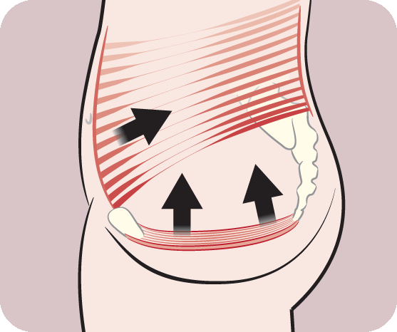 How Does Pelvic Floor Strong Work?